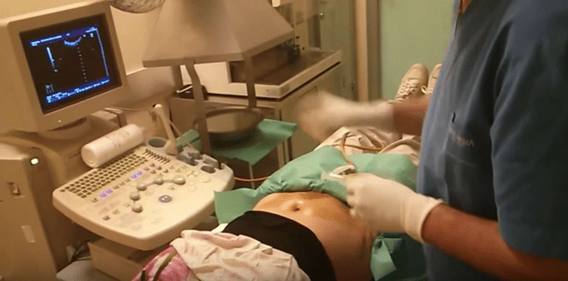 Amniocentesi  consigli e curiosità