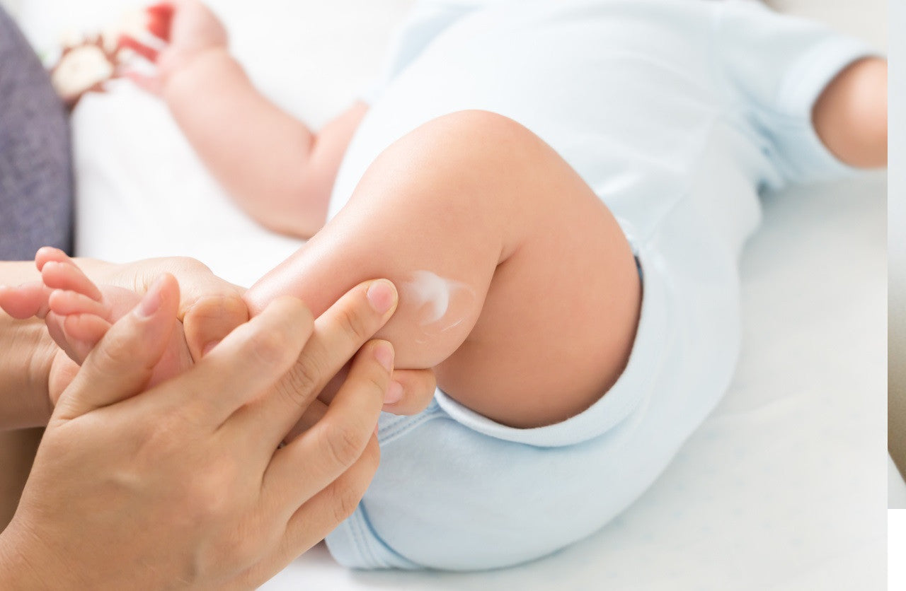 Micosi o funghi della pelle nei bambini:sintomi e cure